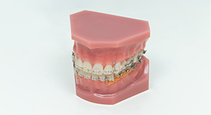 歯並びの健康を保つメンテナンス